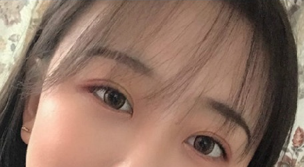 贵阳做双眼皮+膨体隆鼻的医院医生哪里好?