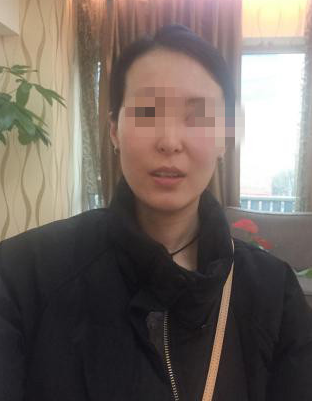 成都天姿面部填充果怎么样？