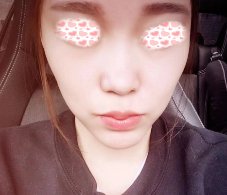 北京沃尔刘彦军鼻部手术做的好不好？