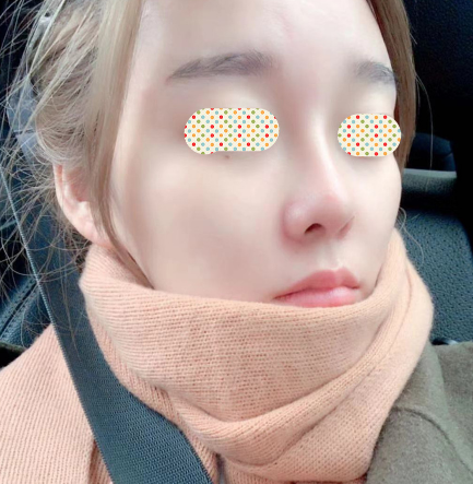 北京沃尔刘彦军鼻部手术做的好不好？