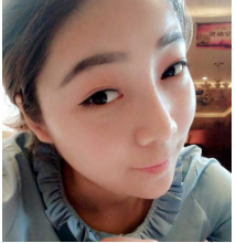 重庆军美曾令宇鼻部手术隆鼻术后恢复过程图