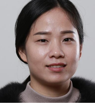 苏州做的双眼皮+开内眼角手术案例