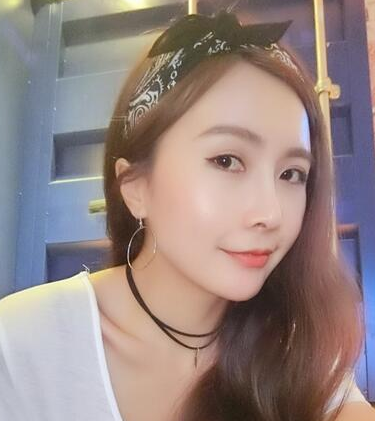上海自体脂肪填充全脸+鼻部手术的案例