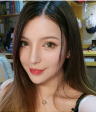 广州做的鼻部手术隆鼻手术案例