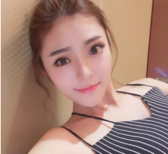 西安做的隆鼻修复手术案例