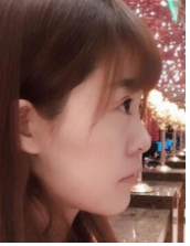 廊坊面部脂肪填充+鼻部手术手术案例