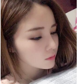 在八大处做的鼻部手术，来分享我的果咯~