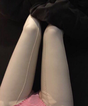 长沙吸脂哪里好?来看我的大腿吸脂分享