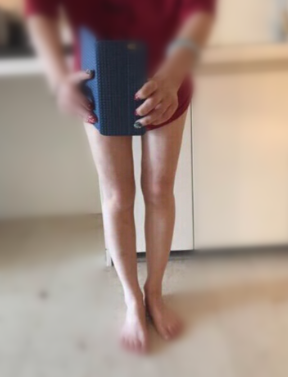 长沙吸脂哪里好?来看我的大腿吸脂分享