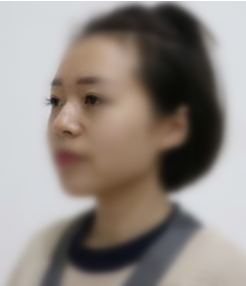 南京做的鼻部手术手术