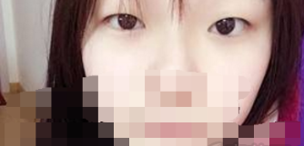 上海九院整形外科苏微洁做双眼皮手术怎么样?