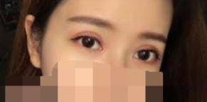 成都莱尹刘辅容做双眼皮修复价格 有负面吗?