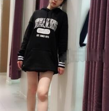 北京东方和谐冯斌吸脂怎么样 失败有吗?