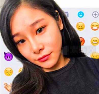 深圳非凡罗奇下颌角磨骨怎么样 有负面吗?