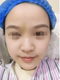 何栋良做鼻子怎么样 多少钱?
