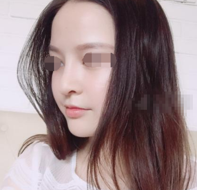 何栋良做鼻子怎么样 多少钱?