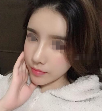 罗汇东王军隆鼻谁好,多少钱?