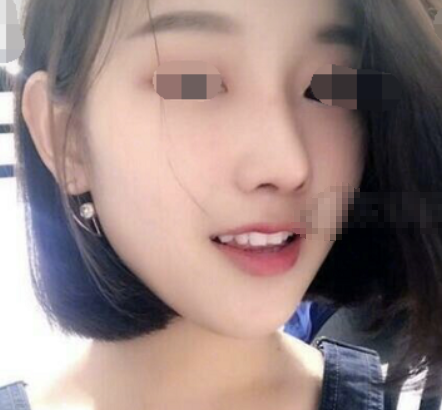 上海容妍李昕鼻部手术怎么样?
