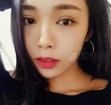 大连何医生何栋良双眼皮做的怎么样?