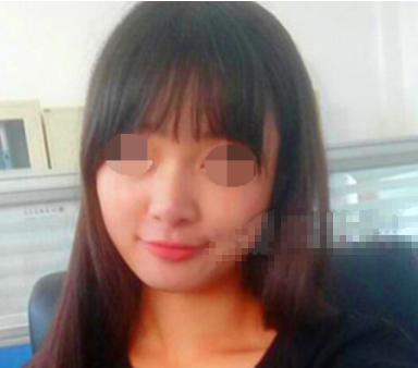 上海九院魏皎鼻部手术手术案例