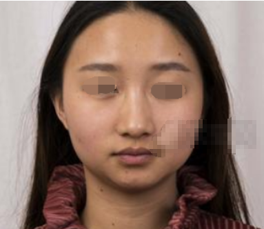 八大处王欢隆鼻怎么样,价格是多少?