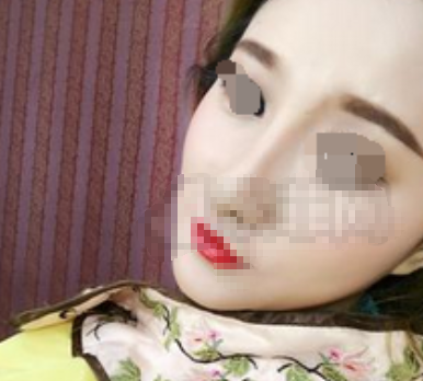 八大处王欢隆鼻怎么样,价格是多少?