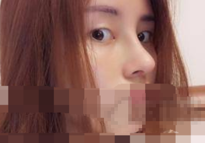 江苏省中医院陈刚医生隆鼻怎么样,有案例吗?