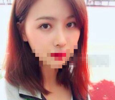 深圳罗湖协同李本龙眼部手术怎么样,有案例吗?