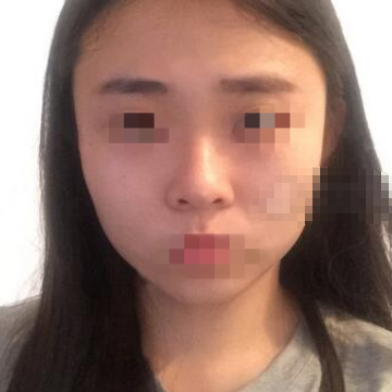 上海九院魏皎隆鼻怎么样,有案例吗?