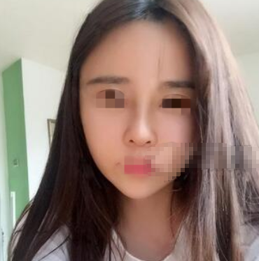 上海九院魏皎隆鼻怎么样,有案例吗?