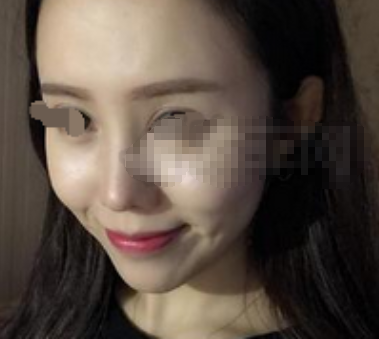 武汉天佑医院田霞隆鼻怎么样,价格多少?