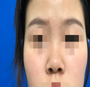 福建星龄王召克隆鼻怎么样,有案例吗?