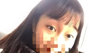 重庆妃妍申霄双眼皮怎么样,有案例吗?