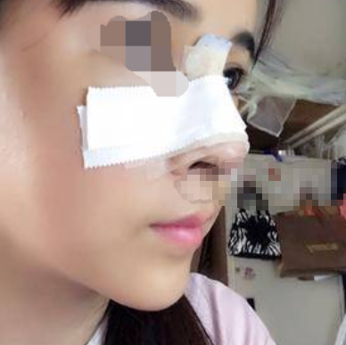 武汉协和钟爱梅隆鼻怎么样,有案例吗?