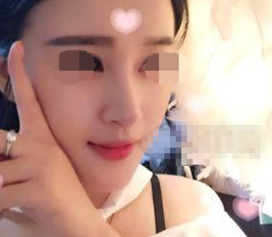 武汉天佑严玲玲做鼻子怎么样,靠谱吗?