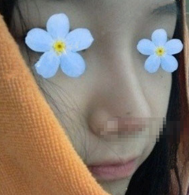 武汉协和王巍隆鼻怎么样,有案例吗?
