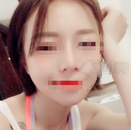 上海容妍李昕隆鼻怎么样 失败多吗?