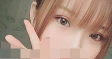 上海九院苏微洁双眼皮怎么样 负面多吗?