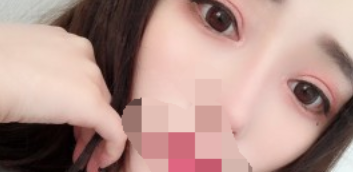 北京八大处杨晓楠双眼皮果怎么样有案例吗？