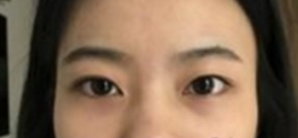 成都西婵 华美紫馨 米兰柏羽双眼皮哪个好?