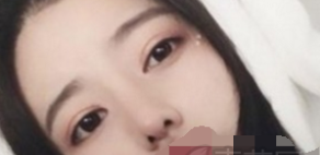 成都西婵 华美紫馨 米兰柏羽双眼皮哪个好?