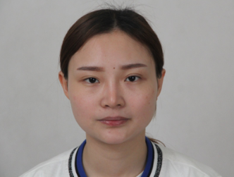 上海愉悦美联臣曹栋弼做下颌角怎么样?