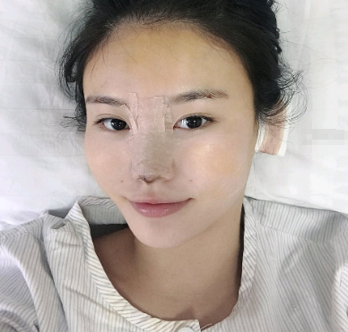 武汉聂祝锋隆鼻怎么样?隆鼻有案例吗?