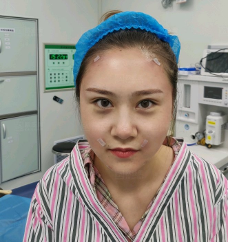 深圳欧亚美何德文面部填充怎么样?