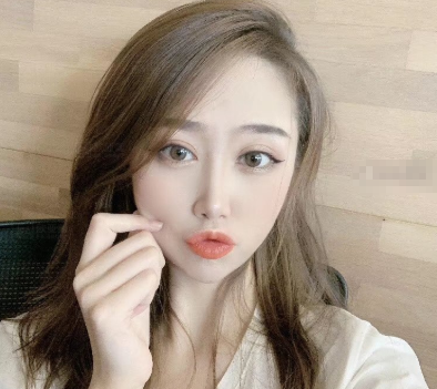 深圳欧亚美何德文面部填充怎么样?