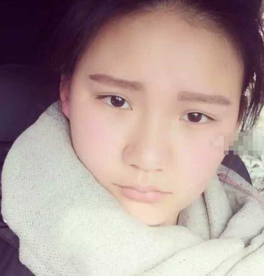 宜昌华美望月做鼻子怎么样?隆鼻多少钱?