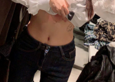 成都怡脂邓萌腰腹吸脂会反弹吗?有案例吗?
