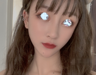 成都润美玉之光刘中国面部填充果怎么样?