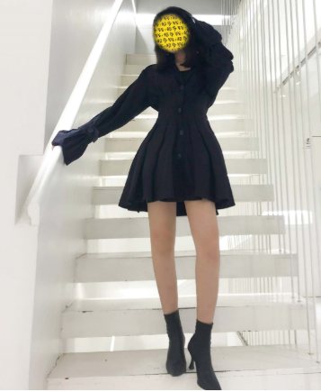 深圳妍熙李静大腿抽脂怎么样?会反弹吗?