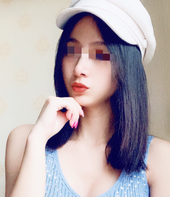 上海华美王荣锡面部填充怎么样?
